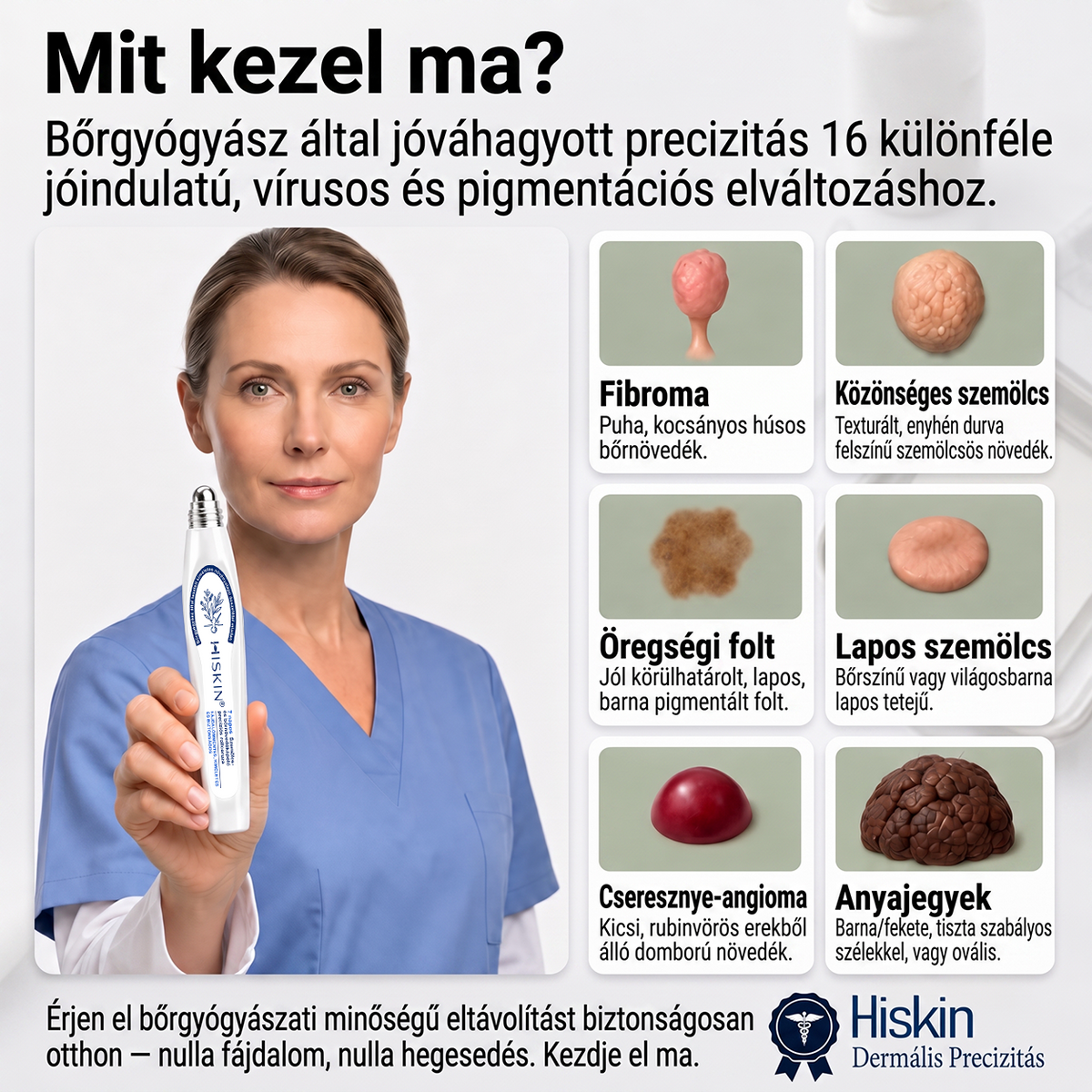 💙Hivatalos Márkabolt | 🚢 Hiskin® 7 napos Szemölcseltávolító Roll-on Ápoló Folyadék (Fájdalommentes rollerball technológia, hegek nélkül) 🐬