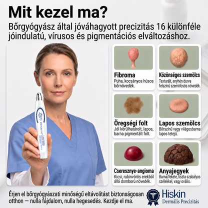 💙Hivatalos Márkabolt | 🚢 Hiskin® 7 napos Szemölcseltávolító Roll-on Ápoló Folyadék (Fájdalommentes rollerball technológia, hegek nélkül) 🐬
