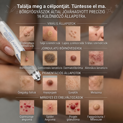 Hivatalos Márkabolt | Hiskin® 7 napos Szemölcseltávolító Roll-on Ápoló Folyadék (Fájdalommentes rollerball technológia, hegek nélkül) 🐬