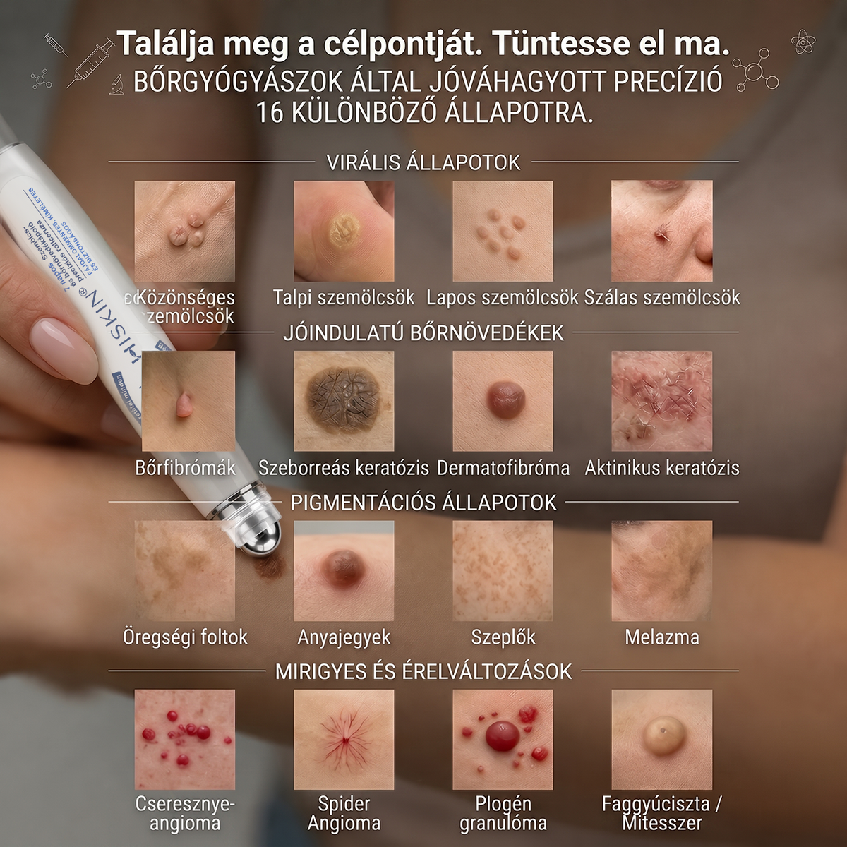 💙Hivatalos Márkabolt | 🚢 Hiskin® 7 napos Szemölcseltávolító Roll-on Ápoló Folyadék (Fájdalommentes rollerball technológia, hegek nélkül) 🐬