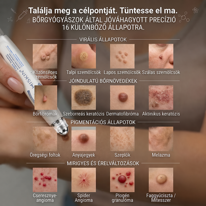 💙Hivatalos Márkabolt | 🚢 Hiskin® 7 napos Szemölcseltávolító Roll-on Ápoló Folyadék (Fájdalommentes rollerball technológia, hegek nélkül) 🐬