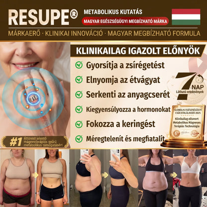 Resupe® Fogyókúrás Anyagcsere Mágneses Terápiás Gyűrű: Hárommagos Anyagcsere Aktiválás — Mindössze 30 perc naponta a Fogyás és a Nyirokkeringés támogatására — Plusz ízületi enyhülés, jobb alvás és mentális tisztaság.